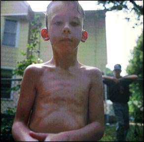 Boy with Red Ears.